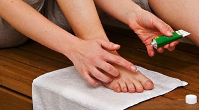 третман на габа на ноктите на нозете со маст